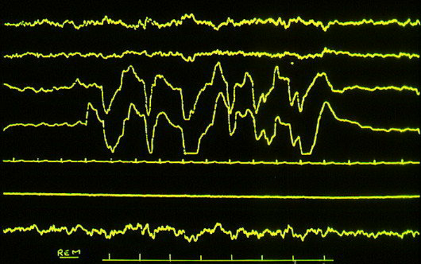Фаза быстрого сна: наибольшую активность проявляют те области мозга, которые управляют движениями глаз, это третья и четвёртая линии сверху. (Рисунок James Holmes.)