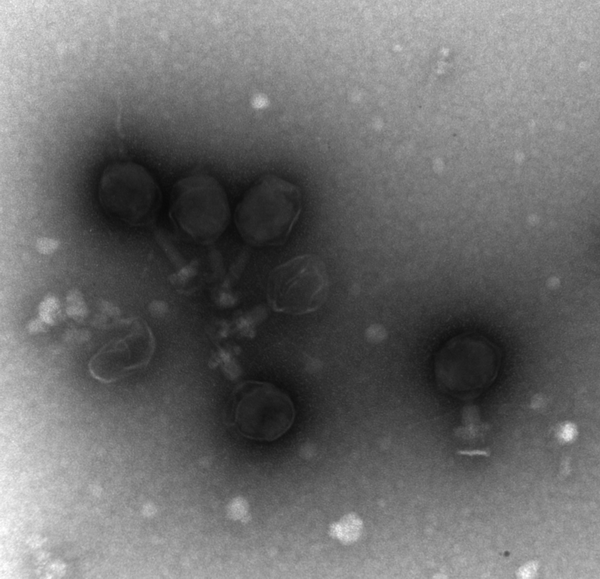 Бактериофаги, специализирующиеся на морских бактериях Prochlorococcus (фото авторов исследования)